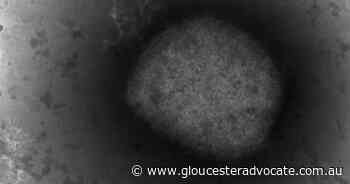 Monkeypox a moderate risk to world: WHO - Gloucester Advocate