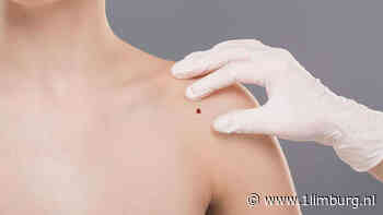 Limburg Centraal: Viecuri in actie tegen huidkanker - 1Limburg | Nieuws en sport uit Limburg