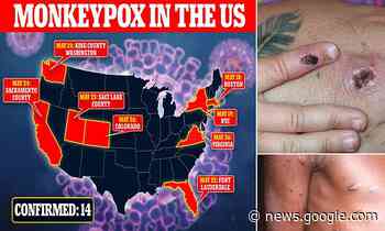 First potential human-to-human transmission of monkeypox detected in the United States - Daily Mail