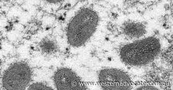 Monkeypox infected can isolate at home: UK - Western Advocate