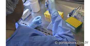 COVID-19: Imbituba registra 57 novos infectados e casos ativos sobem 154% em SC em um mês; 37 municípios estão em alerta alto - Portal AHora