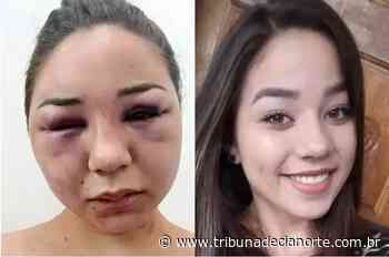 Acusado de agredir e deixar jovem com rosto desfigurado em Tapejara é condenado – Tribuna de Cianorte - Tribuna de Cianorte