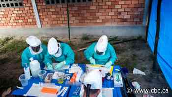 Monkeypox warnings 'went ignored,' and now world must brace for more outbreaks: scientists