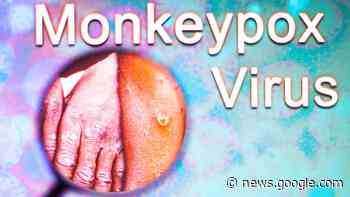 WHO says monkeypox has been spreading undetected as global cases rise to more than 550 - CNBC