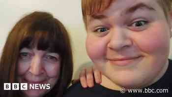 Hull teen with rare heart defect defies odds to thrive - BBC