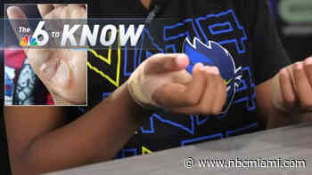 6 to Know: Family Claims Teacher Didn't Respond When Student Burned Hands