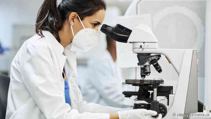 Alberta announces changes to provincial lab services