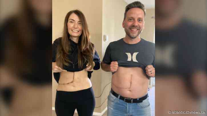 Matching scars: Liver donor, recipient meet face-to-face for the first time since transplant