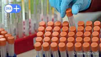 Corona heute in Dresden: Inzidenz und Lage in den Kliniken am 02.06.2022 - dnn.de