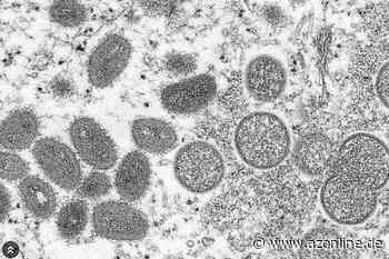 Erster Fall von Affenpocken im Kreis Coesfeld - Allgemeine Zeitung