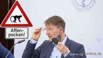Affenpocken-News: Weitere Fälle in Deutschland – Lauterbach macht klare Ansage zur Isolation - op-online.de