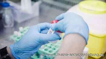 Affenpocken in Deutschland: Erster Fall im Raum Hannover nachgewiesen