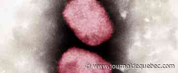 Variole du singe : 77 cas au Canada, situation «préoccupante» au Québec