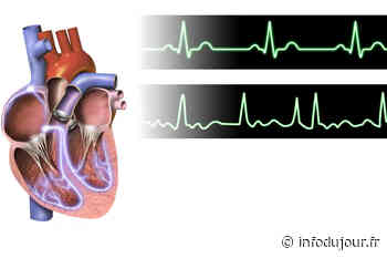 Nancy : Une journée pour parler de la Fibrillation Atriale - Infodujour.fr