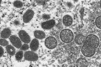 Two distinct monkeypox variants found in U.S., adding to outbreak’s mystery