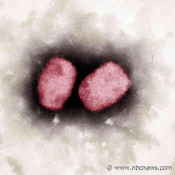 Monkeypox may have been spreading 'under the radar' for years