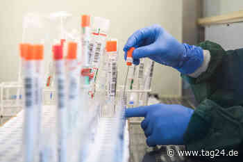 Nun auch in Aachen: Verdacht auf Affenpocken-Infektion - TAG24