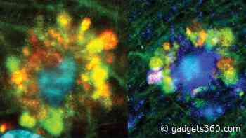 Neural ‘Poisonous Flowers’ Could Be the Primary Cause of Alzheimer’s Disease, Says New Study