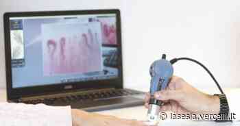 Vercelli: giornata della diagnosi precoce della Sclerosi sistemica - La Sesia | Cronaca