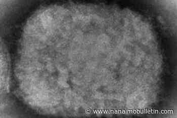 1st case of monkeypox confirmed in B.C.; risk to public remains low, says BC CDC