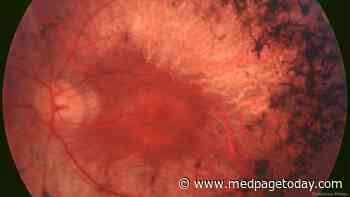 Common Inherited Retinal Diseases: Presentation, Diagnosis, Treatment