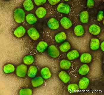 Monkeypox FAQ: Where Did It Come From? How Is It Transmitted? What Are the Symptoms?