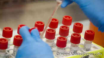 Coronavirus: UAE reports 572 Covid-19 cases, 530 recoveries, no deaths - Khaleej Times
