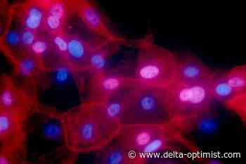 Studies pinpoint which patients can skip cancer treatments - Delta Optimist