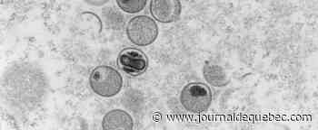 Variole simienne : 90 cas déclarés au Québec
