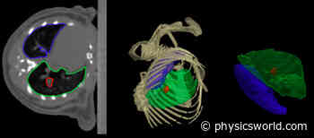 Focus on machine learning models in medical imaging – Physics World - physicsworld.com