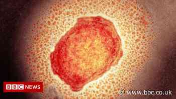 What is monkeypox and how do you catch it?