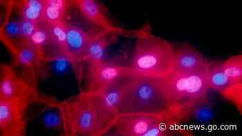 Some cancer patients can skip treatments, 2 studies show