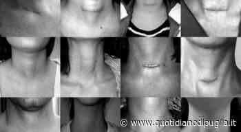 Troppi tumori, a Manduria il raduno musicale organizzato da Arnò. Tra gli ospiti Tricarico, Populous e Contini - quotidianodipuglia.it