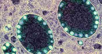 Alberta records 42 more COVID-19 deaths, hospitalizations drop