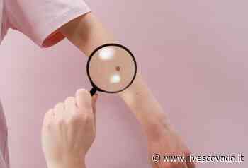 "Attenti al Neo", torna a Capri l’iniziativa di prevenzione oncologica della Lilt di Napoli - Il Vescovado Costa di Amalfi