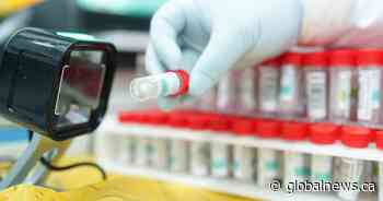 Ontario COVID numbers: 549 people in hospital, 118 in intensive care