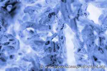 Genomic instability and nuclear architecture in cancer - Open Access Government