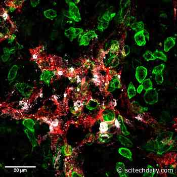 The Double Advantage of Killer T-Cells To Prevent Cancer Metastases