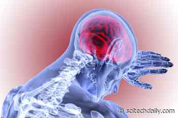 Want To Reduce Stroke Risk? Researchers Discover Simple Secret