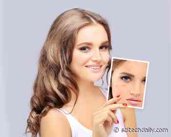 3 Vitamins That Fade Acne Scars Fast
