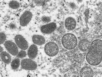 Quebec officials say 98 monkeypox cases detected, more than 1600 vaccinated - Windsor Star