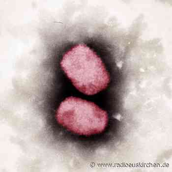 Stiko empfiehlt Affenpocken-Impfung für Risikogruppen - radioeuskirchen.de