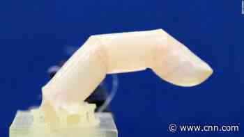Scientists designed a humanoid robotic finger with living humanlike skin