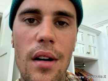 Justin Bieber choc: "Un virus mi ha paralizzato metà faccia"