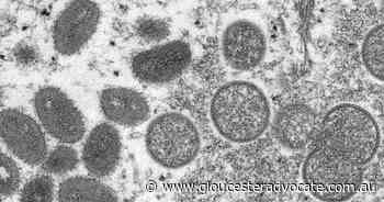 Vic confirms Aust's eighth monkeypox case - Gloucester Advocate