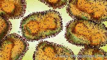 CDC: No Evidence Monkeypox Is Airborne