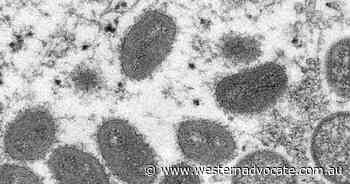 Unclear if monkeypox peaked: UK scientists - Western Advocate