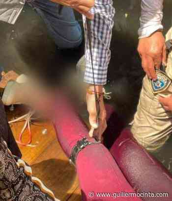 Regidora de Cuernavaca Paty Torres; no perdió el pie - Noticias de Morelos - La Crónica de Morelos