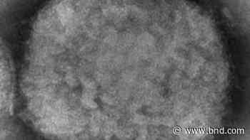 US buys more monkeypox vaccine as global case count grows - Belleville News-Democrat