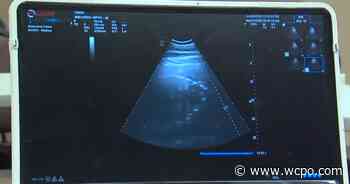 Cincinnati Zoo care team ready for Fiona's sibling to arrive - WCPO 9 Cincinnati